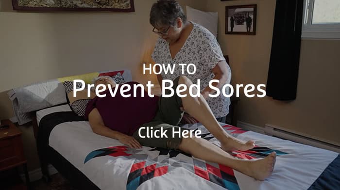 Preventing Bed Sores